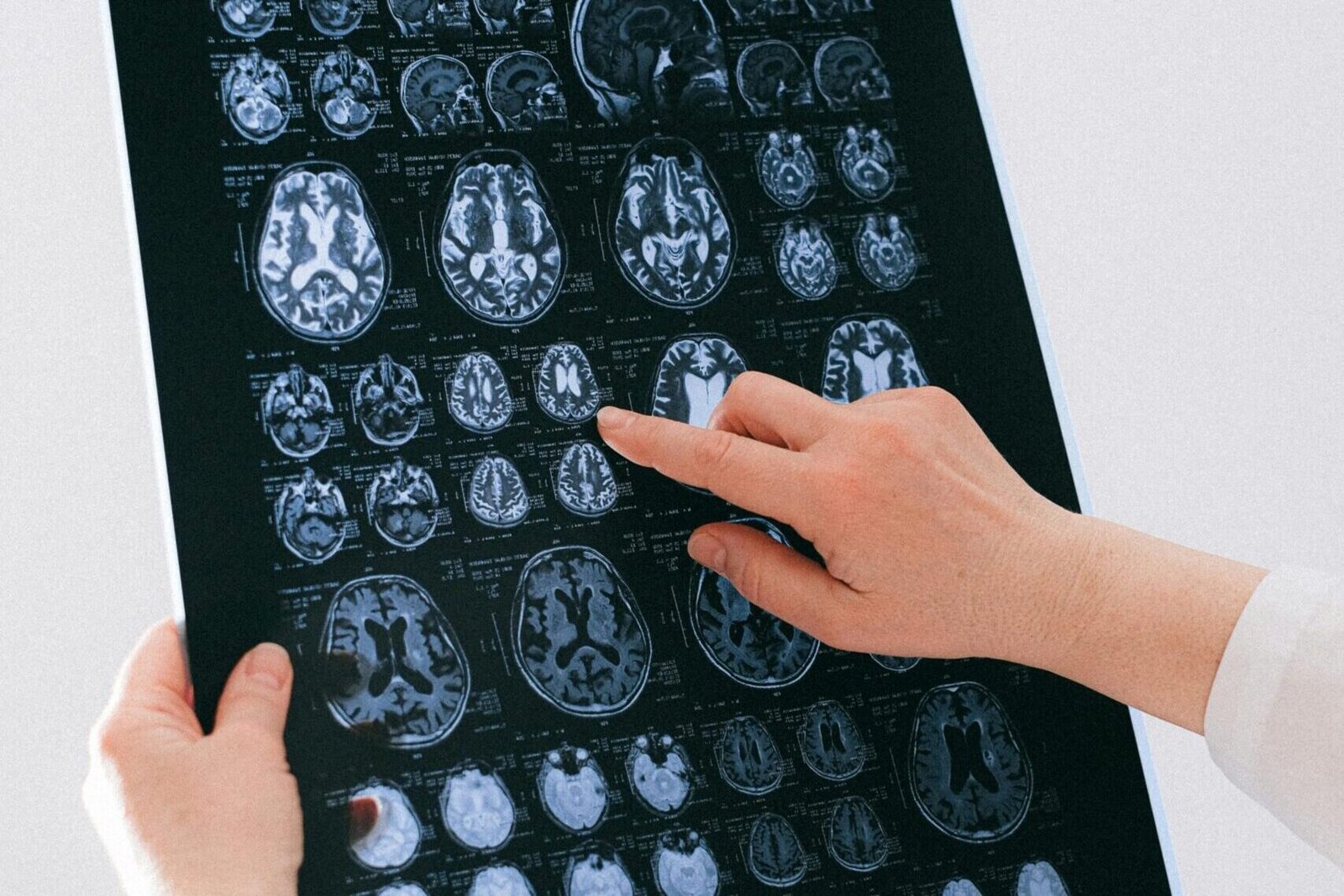 A medical professional examines a brain MRI scan, focusing on neurological health.